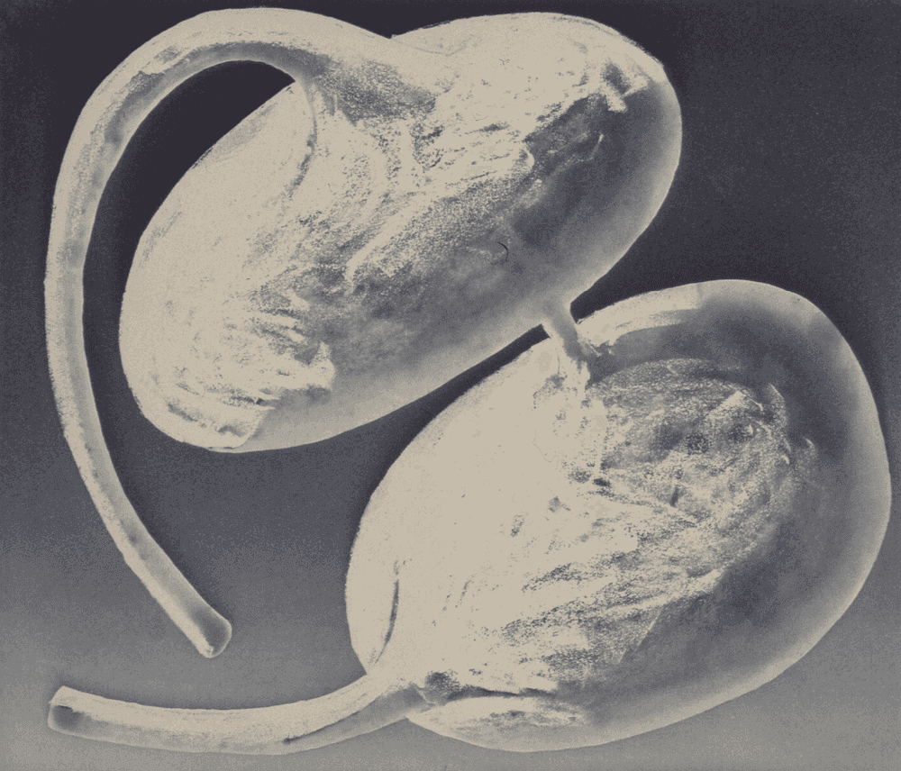 Tony Cragg, ‘ContainerIII’, 1988, Print, Aquatint on paper, null, 